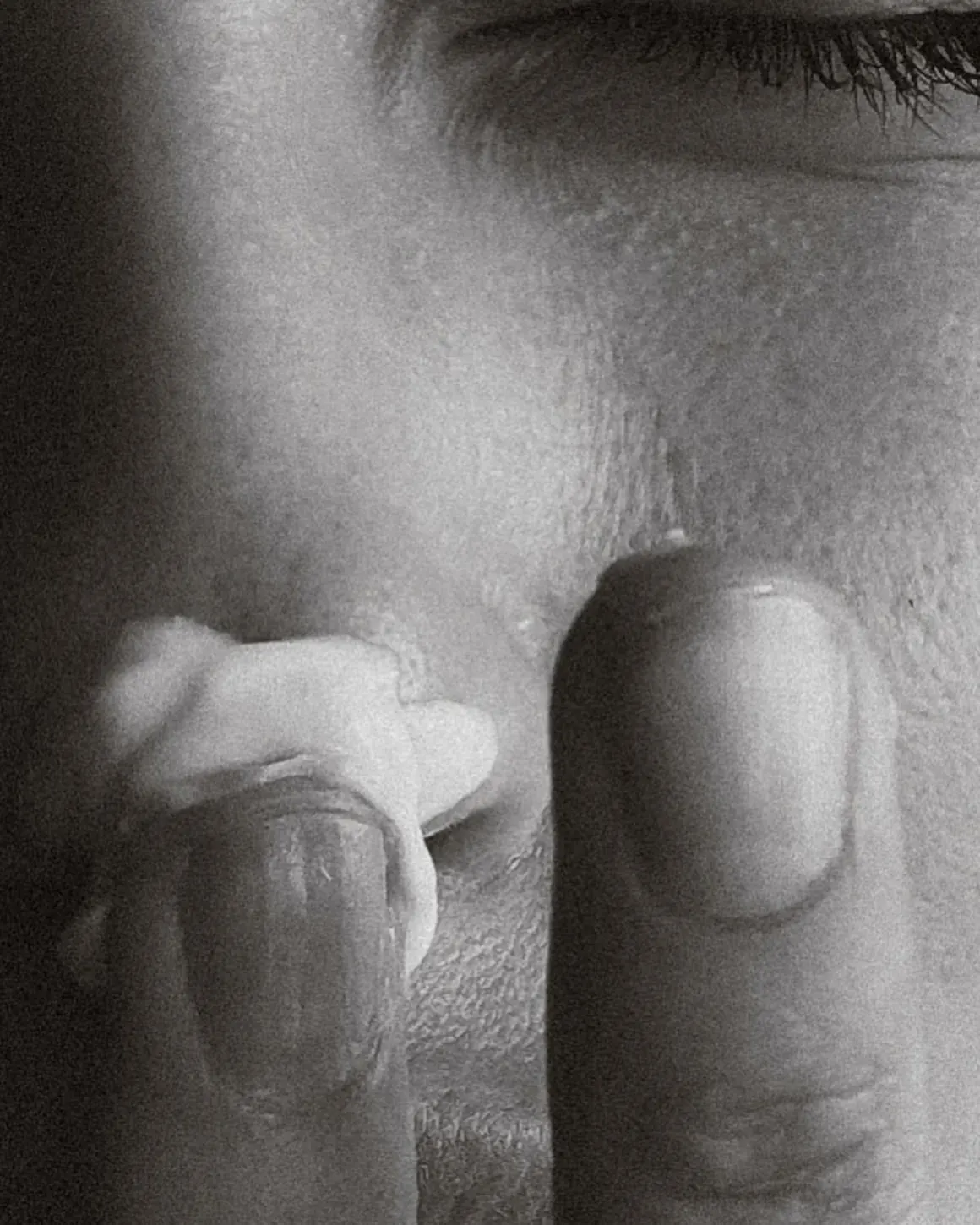 Black and white close-up of a finger touching the skin beneath an eye